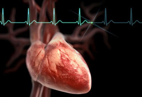 How Blood Pressure Affect The Heart