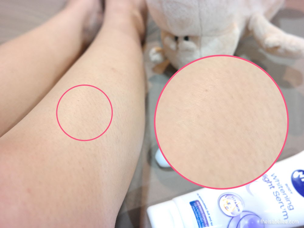 How Often Should You Epilate?