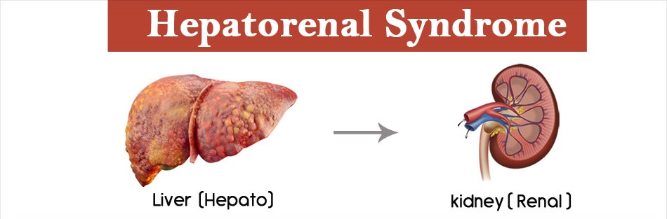 hepatorenal syndrome